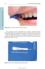 Basic Guide to Dental Procedures 2024 - Image 5
