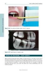 Basic Guide to Dental Procedures 2024 - Image 8