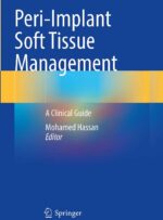 Peri-Implant Soft Tissue Management 2023