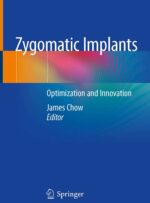Zygomatic Implants Optimization & Innovation 2020