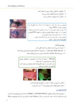 درسنامه فشرده بیماری های دهان - Image 11