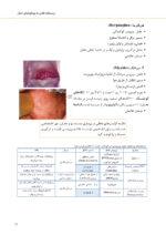 درسنامه فشرده بیماری های دهان - Image 3