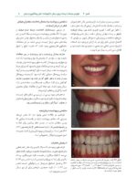(عوارض درمان ایمپلنت های دندانی اتیولوژی، پیشگیری و درمان (فصول منتخب پروتز - Image 7