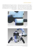 میکروسرجری در اندودانتیکس - Image 9