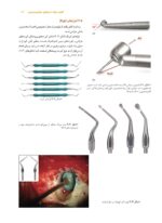 میکروسرجری در اندودانتیکس - Image 2